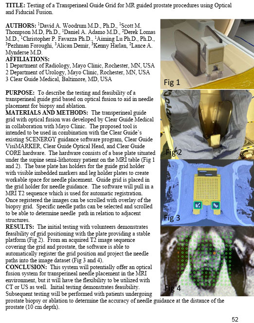 Testing of a Transperineal Guide Grid for MR guided prostate procedures using Optical and Fiducial Fusion